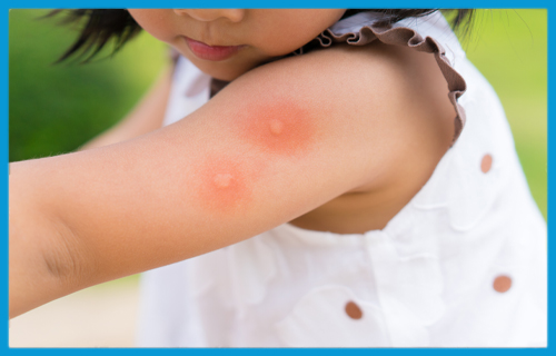 Quels dangers représentent les insectes nuisibles ?