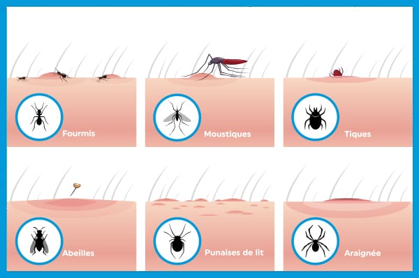 Diaporama sur piqûres les punaises de lit