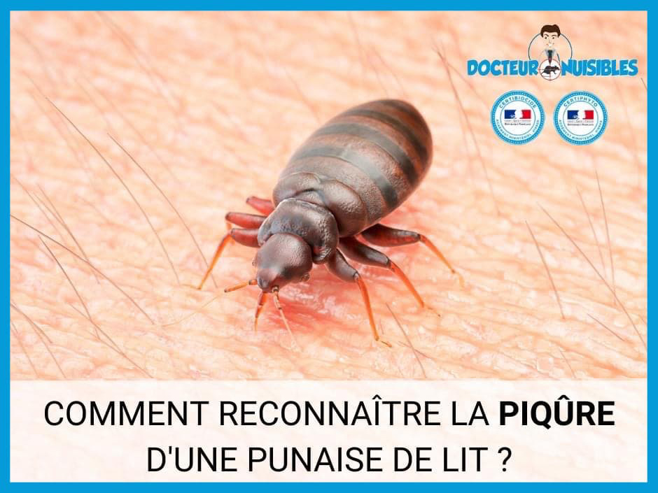 Comment reconnaitre la piqure d'une punaise de lit